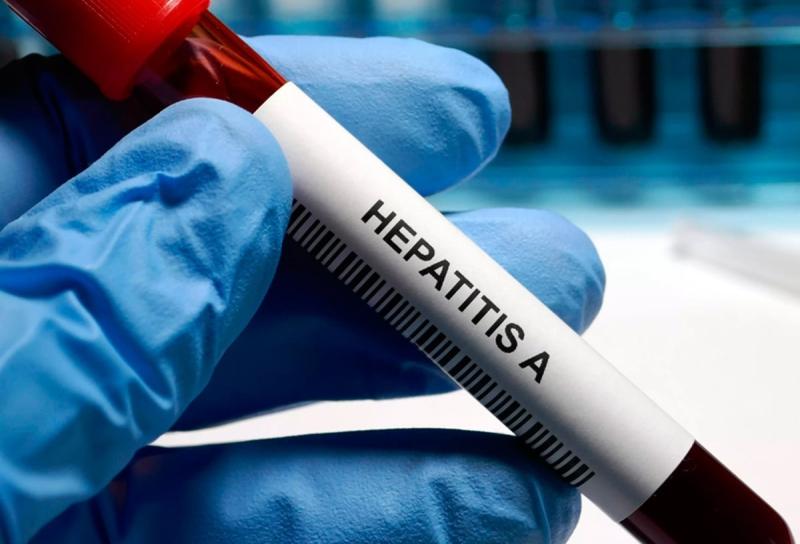 Профилактика гепатита А