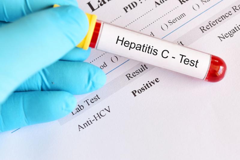 Гепатит С. Что важно знать?